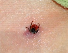 Вслед за холерой в Мариуполь пришла болезнь Лайма