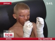 За жизнь маленького "железнодорожного" хулигана борются донецкие врачи