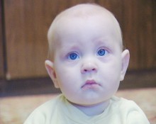 Годовалый ребенок из Родинского срочно нуждается в операции