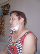После неудачной эпиляции жительница Красноармейска попала в больницу