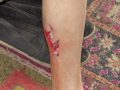В Мирнограде свора собак искусала бабушку