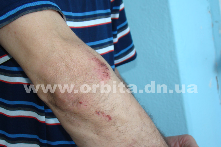 taxist_sbil_velosipedista6