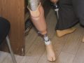 Виїзний прийом лікарів-ортопедів вчергове пройшов у Покровську