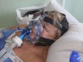 Пацієнти важкі і потребують кисню. В інфекційному відділенні Покровської КЛІЛ зайняті 95 ліжок