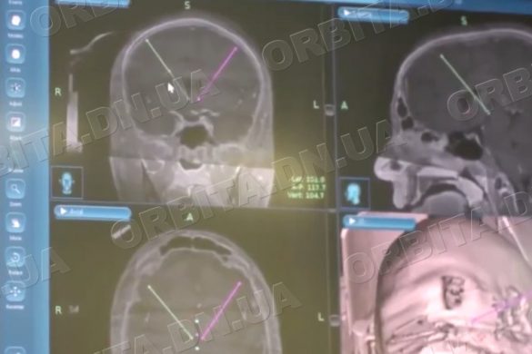 11 квітня – Всесвітній день боротьби з хворобою Паркінсона