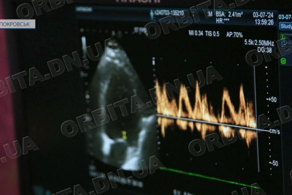 До Всесвітнього дня кардіолога: про здоров’я серця та поради лікарів